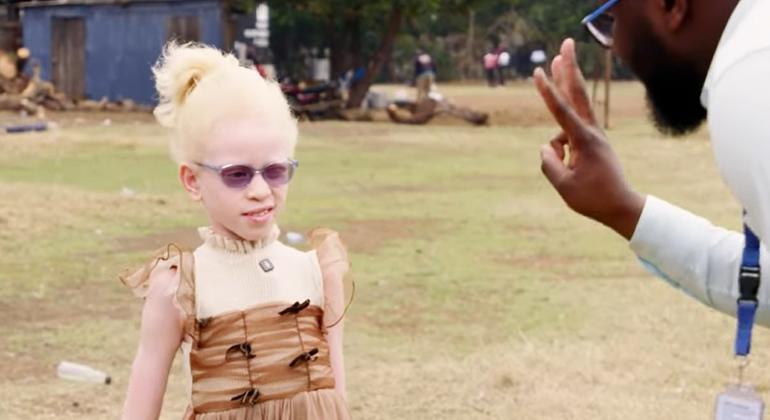 Dia Internacional para Conscientização do Albinismo focam em prevenção do câncer