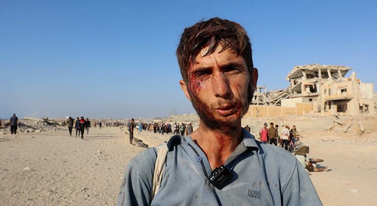 Hospitais em Gaza sobrecarregados com feridos em áreas de distribuição de comida