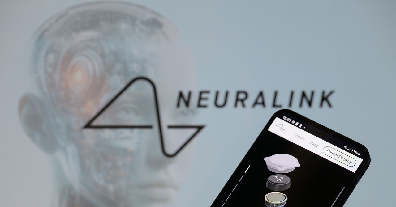 A tentativa de Neuralink para a marca registrada ‘Telepatia’ e ‘Telekinesis’ enfrenta questões legais