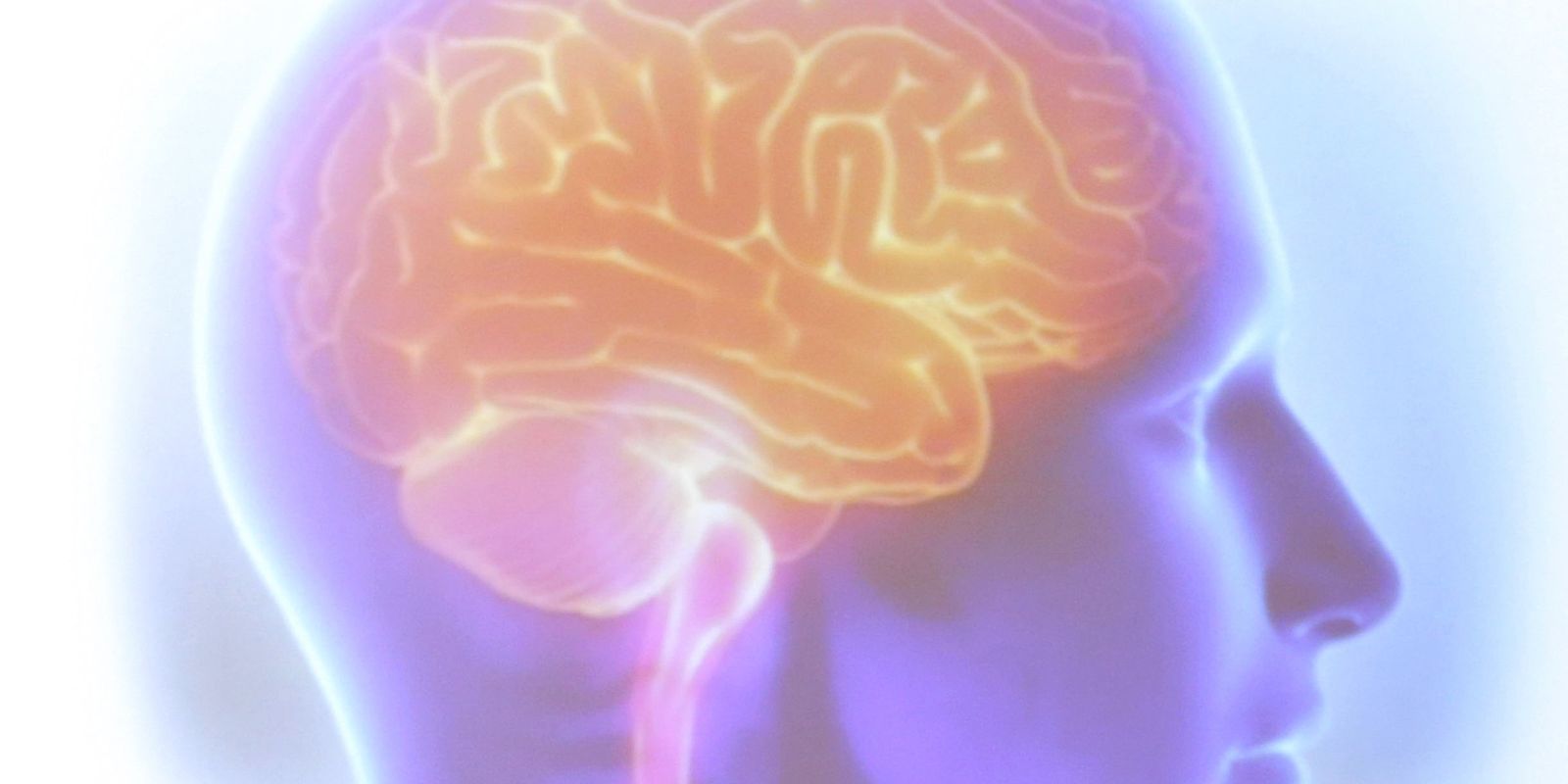 Projeto Ártemis avalia genética de pacientes que sofreram AVC