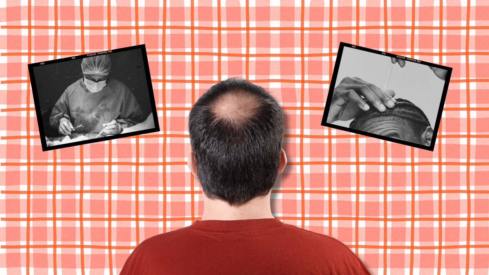 O guia do cara para perder cabelo